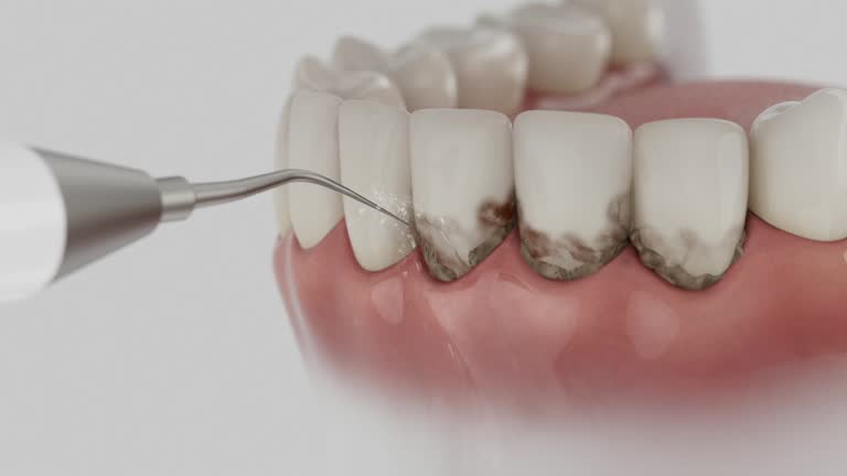 Trusted Teeth Cleaning And Checkup service in West Liberty, KY - Dentist Open Now